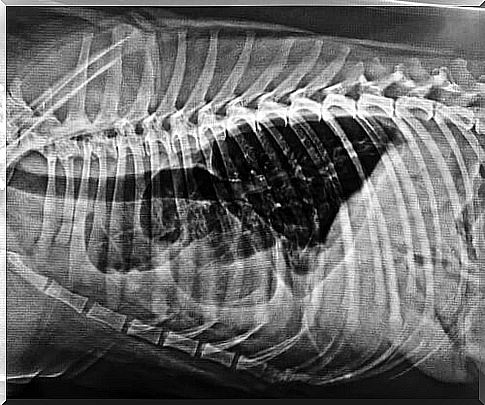 X-ray of cardiovascular disease in dog