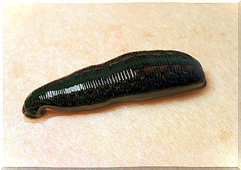 Hirudo medicinalis: the medicinal leech