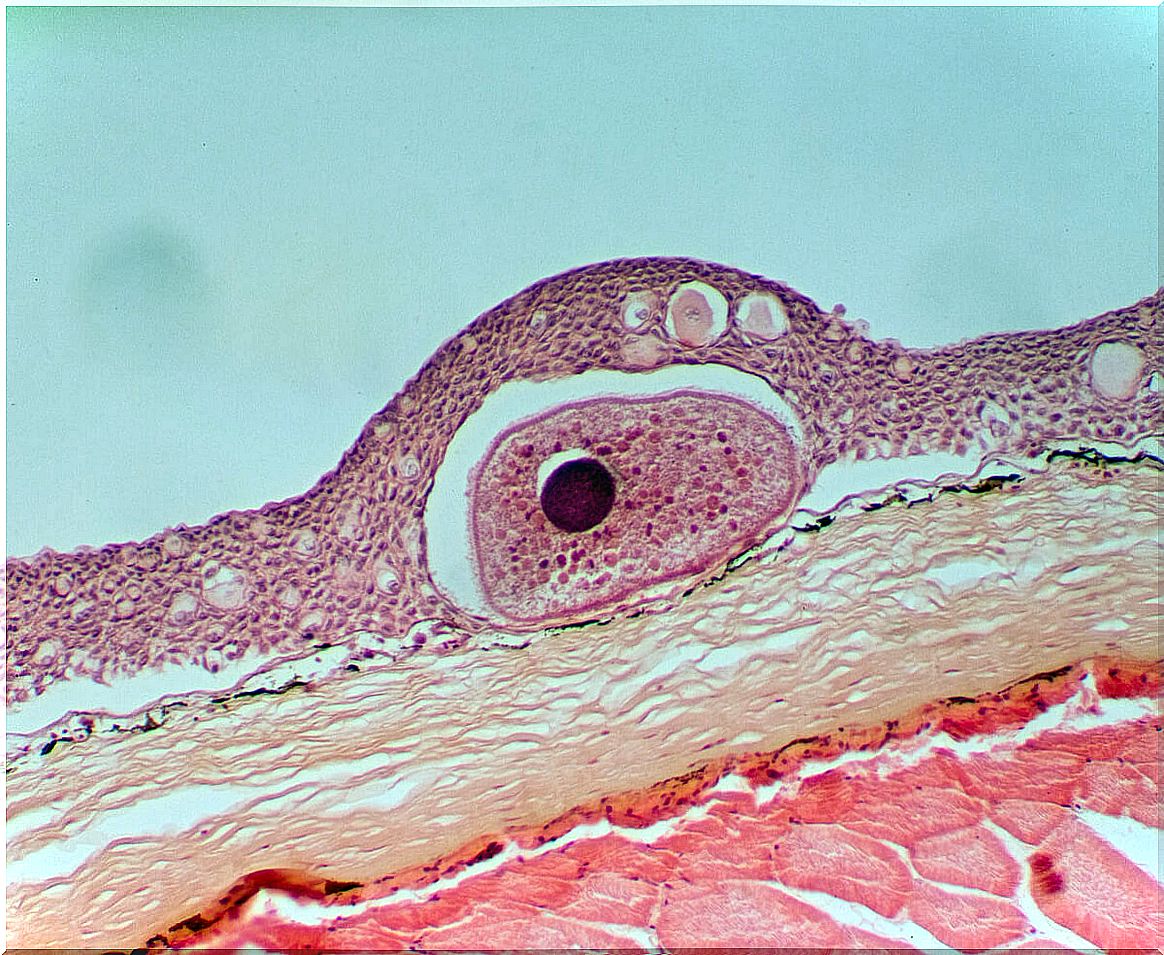 Parásito del pez visto al microscopio.